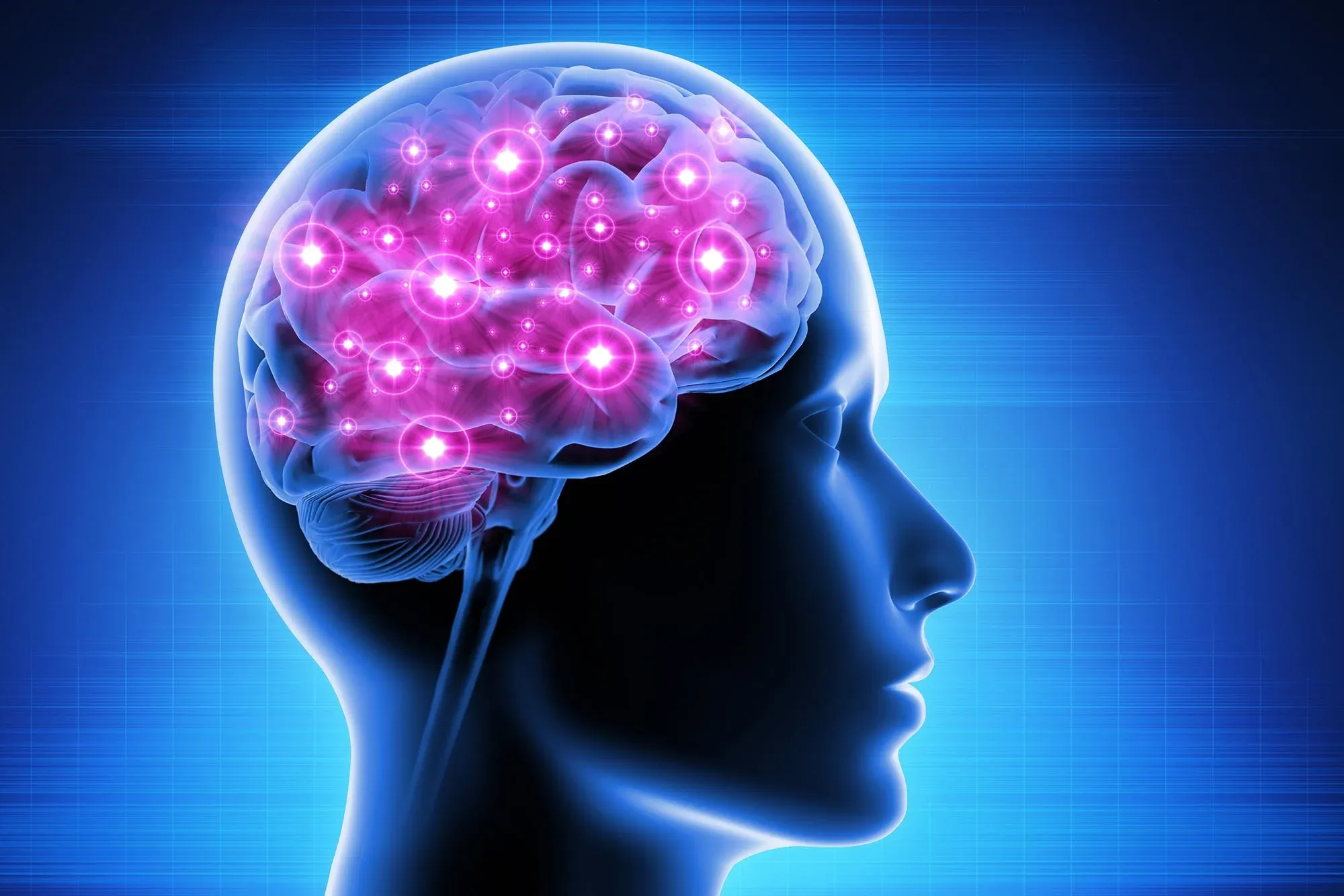 Brain Health at Infinite Health Group